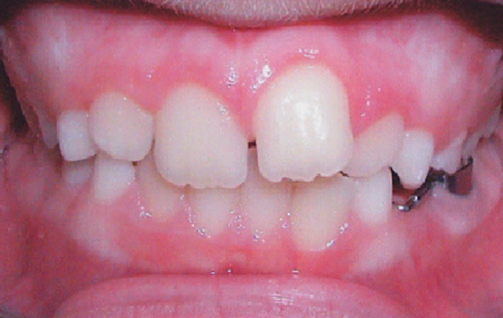 first image